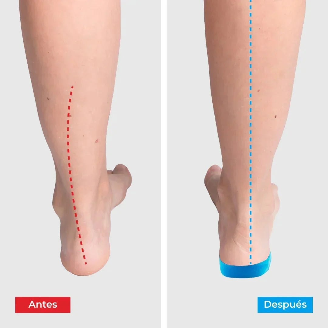 Plantillas ComfyFeet™️ - Disfruta de días sin dolor, sin tratamientos caros ni visitas al médico....